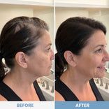 Instant Coverage Hairline Powder