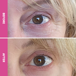 PrimeSkin Magic Repair Serum + PrimeEyes Hydrate