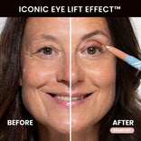 Before and after PrimEyes Eye Brightener showing the Iconic Eye Lift Effect.
