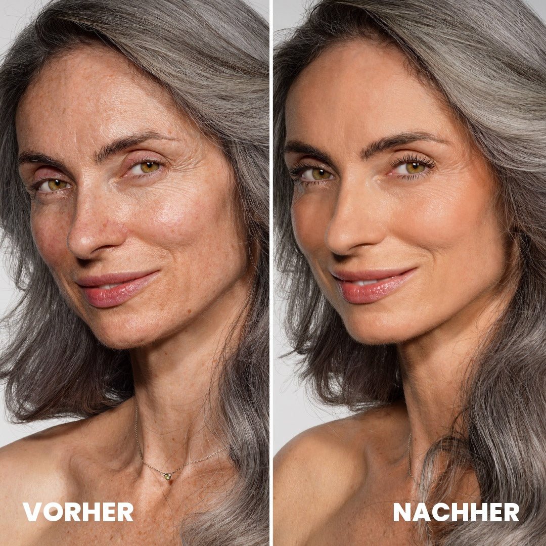 CCF Vorher-Nachher (DE)