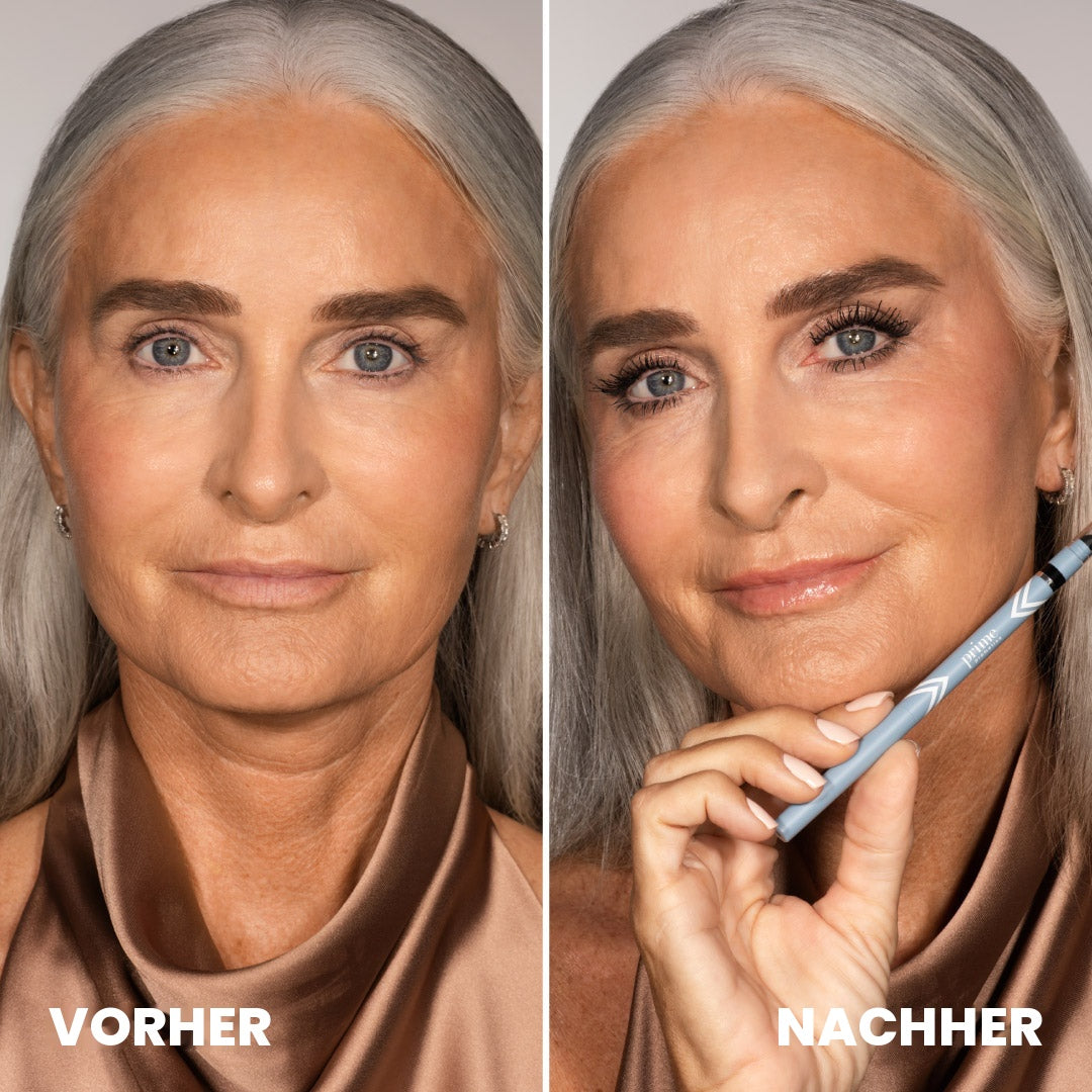 Vorher Nachher