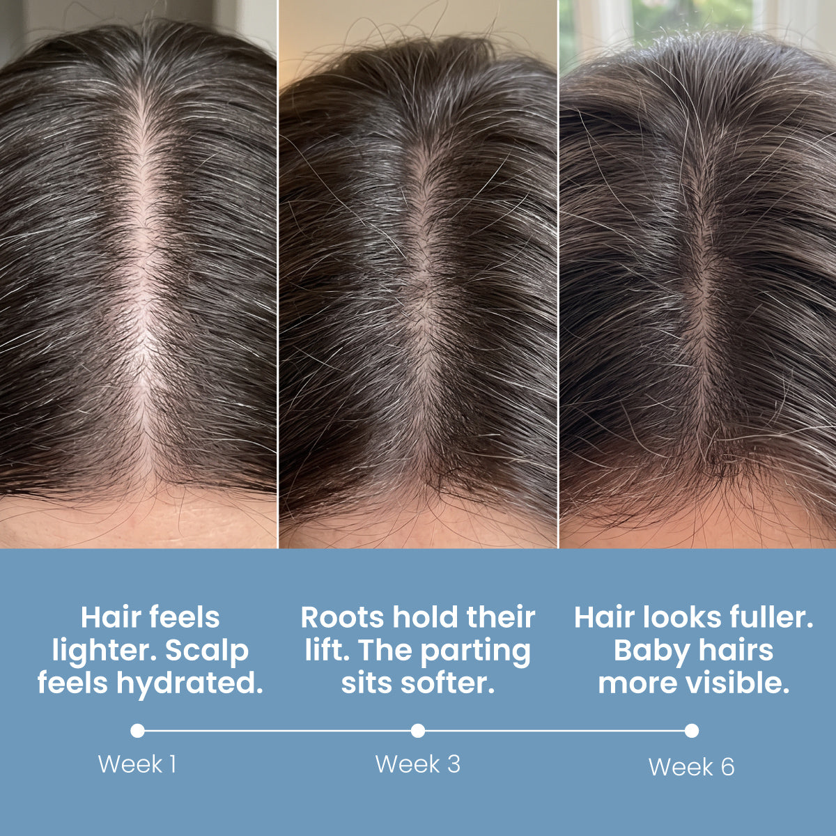 Three close-up images of a hair parting over six weeks illustrate the transformative effects of PrimePrometics™ Multi-Peptide Hair Density Serum. Over time, hair appears shinier and fuller, with captions highlighting increased hydration, improved lift, and greater fullness along with more visible baby hairs.