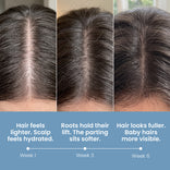 Three close-up images of a hair parting over six weeks illustrate the transformative effects of PrimePrometics™ Multi-Peptide Hair Density Serum. Over time, hair appears shinier and fuller, with captions highlighting increased hydration, improved lift, and greater fullness along with more visible baby hairs.