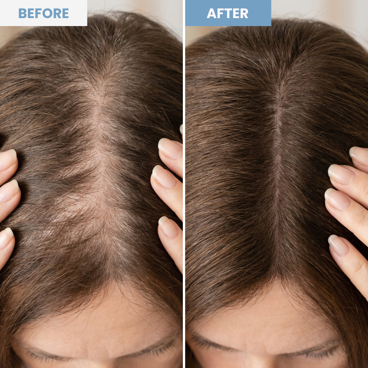 Split image showing the top of a womans head: left side labeled Before with visibly thinning hair, and right side labeled After with fuller, thicker hair and less visible scalp.