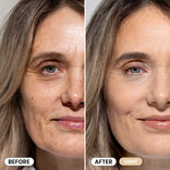 Side-by-side close-ups of a womans face; the left side labeled Before shows more visible wrinkles and uneven skin tone, while the right side labeled After Light shows smoother, more even skin.