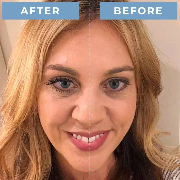 Lashes before using PrimeLash (set 2)